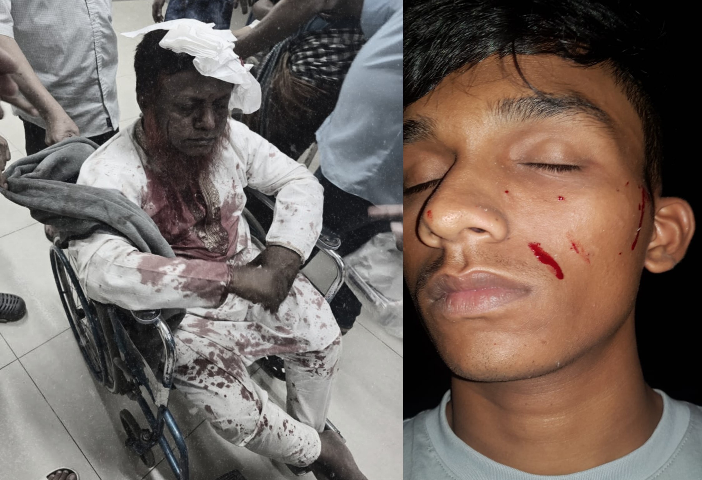 আনোয়ারায় পাউবোর প্রকল্পে চাঁদা ও মাল সরবরাহ নিয়ে বিএনপির দুই গ্রুপে সংঘর্ষ, নিখোঁজ ২